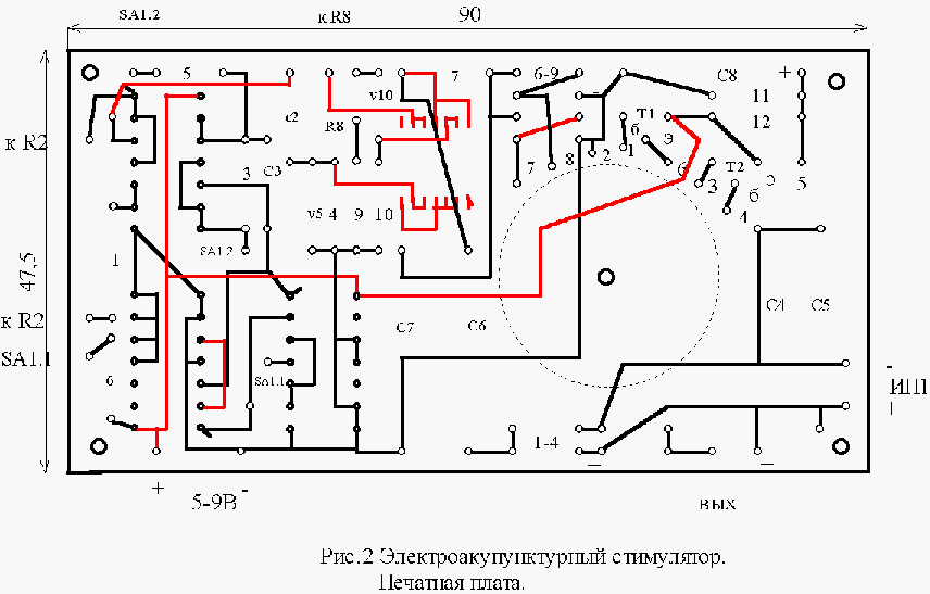 Elektroakupunkturnyy_stimulyator-2.gif