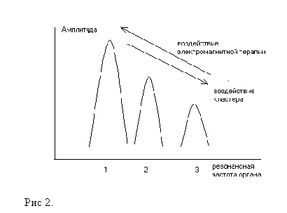 Электромагнитная терапия Elektromagnitnaya_terapiya-2.gif