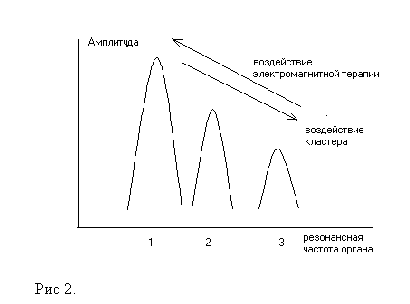 Elektromagnitnaya_terapiya-2.gif